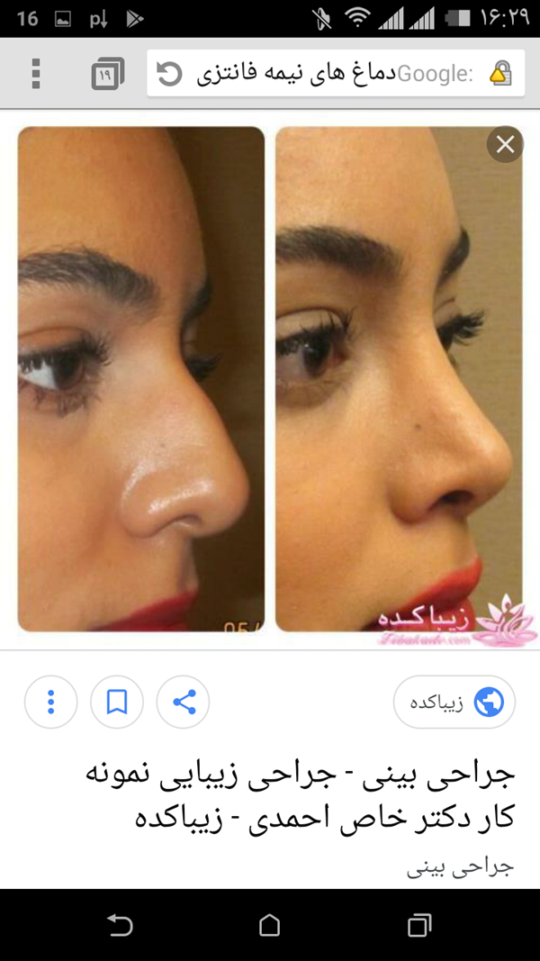 عکس بینی طبیعی نی نی سایت
