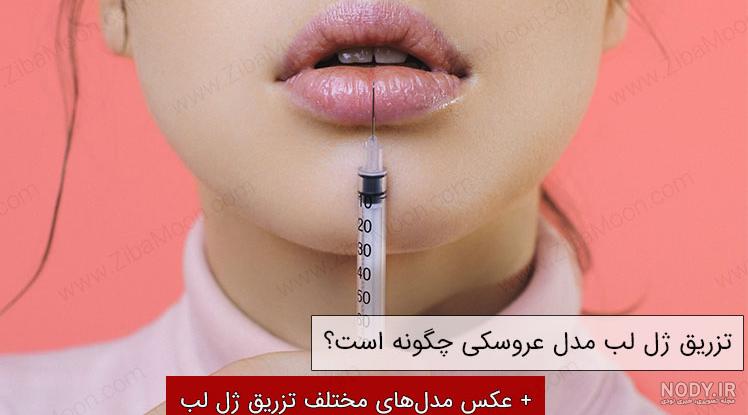 عکس لب ژل عکس لب ژل