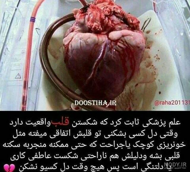 عکس واقعی قلب انسان ها عکس واقعی قلب انسان ها