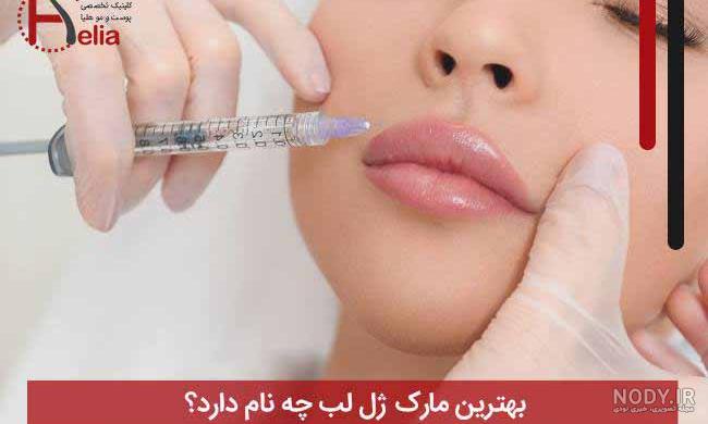 عکس ژل لب روسی عکس ژل لب روسی