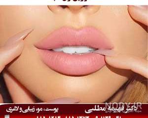 عکس ژل لب یک سی سی عکس ژل لب یک سی سی