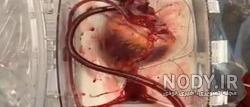 قلب شکسته دختر قلب شکسته دختر