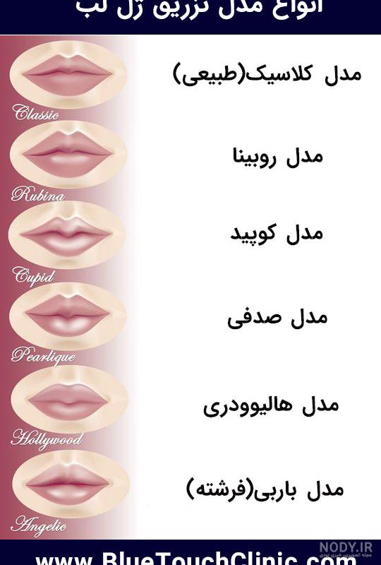 قیمت تزریق ژل لب قیمت تزریق ژل لب