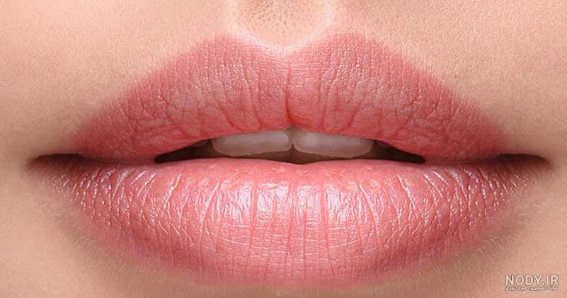 قیمت تزریق ژل لب نی نی سایت قیمت تزریق ژل لب نی نی سایت