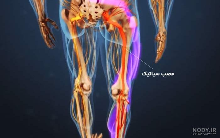 ورزش سیاتیک پای راست ورزش سیاتیک پای راست
