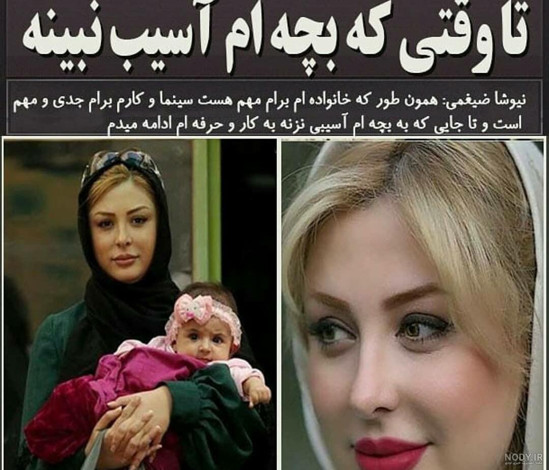 پروتز لب نیوشا ضیغمی