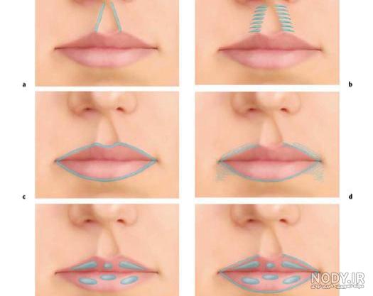 ژل لب کره ای ژل لب کره ای