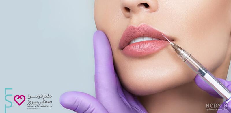 تزریق ژل لب مدل نچرال تزریق ژل لب مدل نچرال