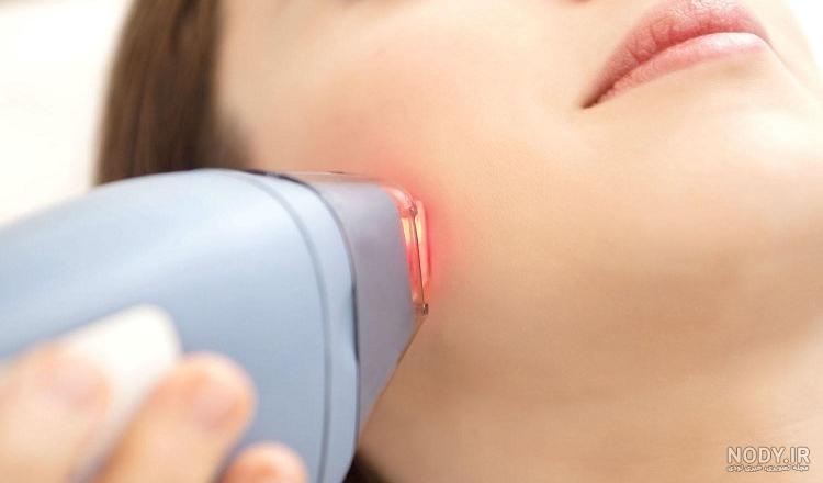 عکس لیزر چشم عکس لیزر چشم