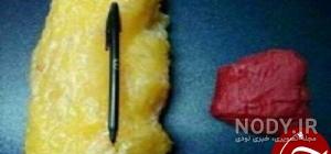 فیلم تخلیه چربی شکم فیلم تخلیه چربی شکم