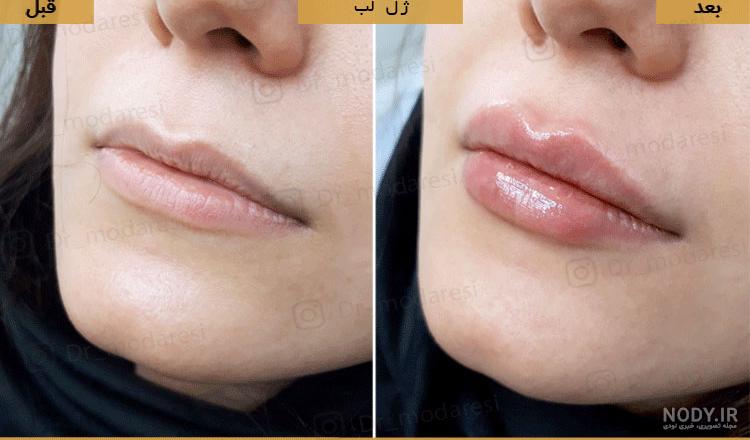 نیم سی سی ژل لب نی نی سایت نیم سی سی ژل لب نی نی سایت