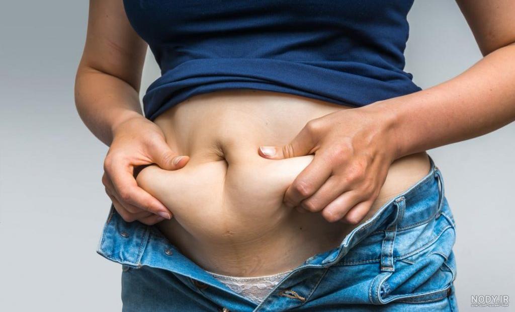 هزینه عمل برداشتن چربی شکم نی نی سایت هزینه عمل برداشتن چربی شکم نی نی سایت