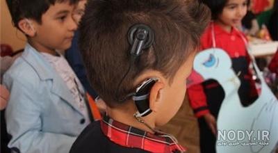 هزینه کاشت حلزون گوش بزرگسالان هزینه کاشت حلزون گوش بزرگسالان