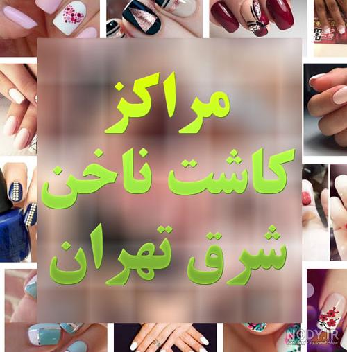 کاشت ناخن کوتاه و طبیعی