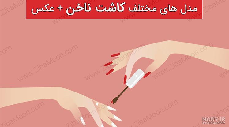 کاشت ناخن کوتاه و طبیعی