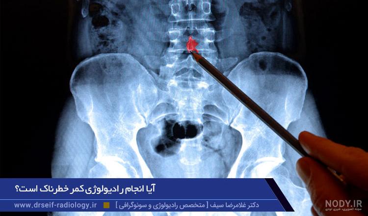 آمادگی برای رادیولوژی کمر