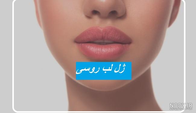 آموزش تزریق ژل لب مدل عروسکی آموزش تزریق ژل لب مدل عروسکی