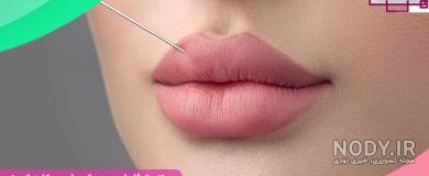 تزریق ژل لب مدل باربی تزریق ژل لب مدل باربی