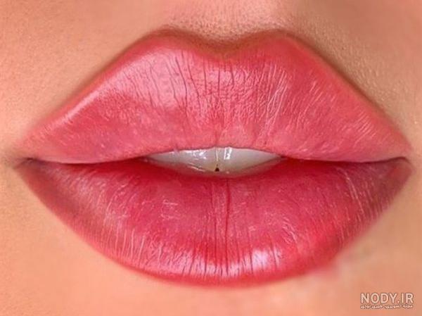 تزریق ژل لب مدل قلبی تزریق ژل لب مدل قلبی