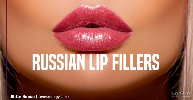 تزریق ژل لب مدل نچرال تزریق ژل لب مدل نچرال