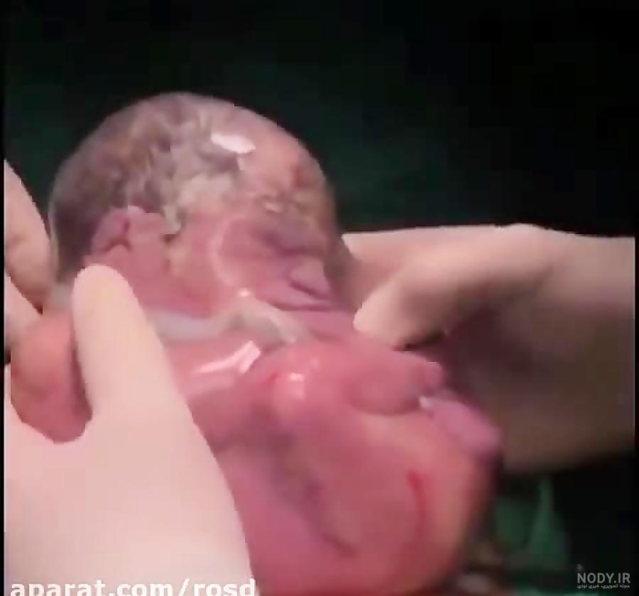 عکس بچه سه ماهه تو شکم مادر