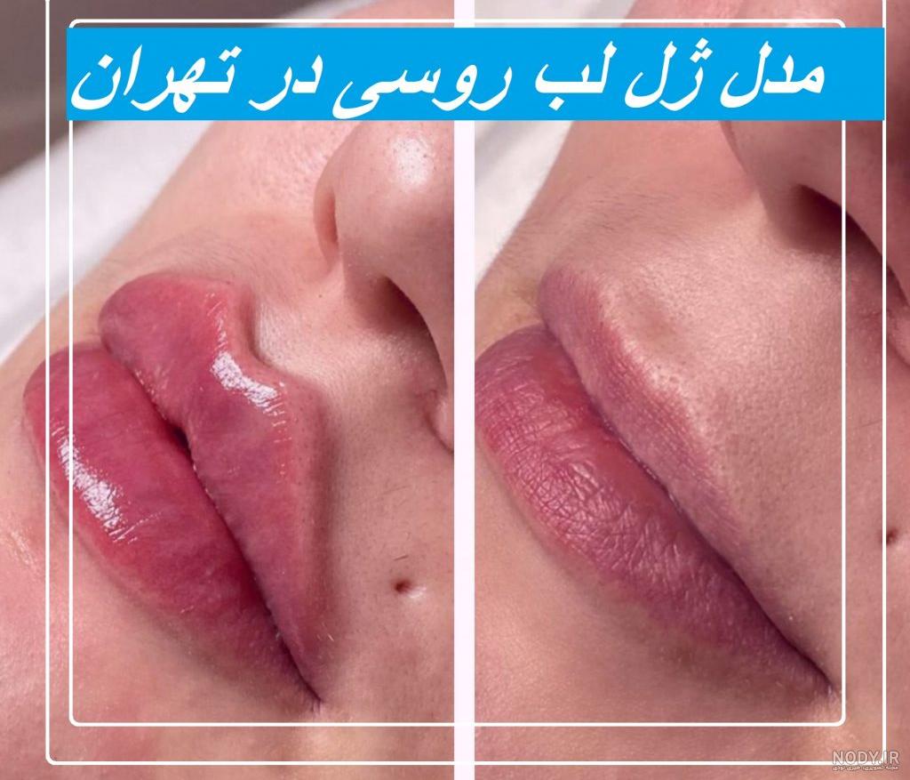عکس لب مدل روسی عکس لب مدل روسی