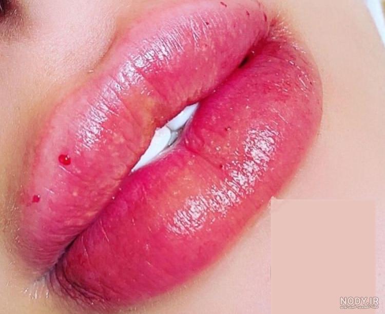 عکس ژل لب مدل روسی عکس ژل لب مدل روسی