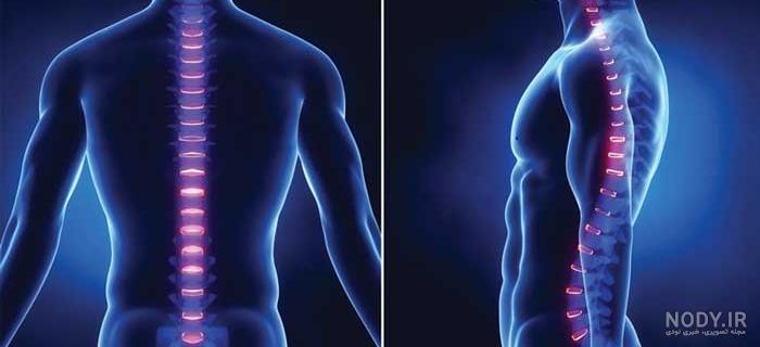 قرص بیزاکودیل برای عکس کمر