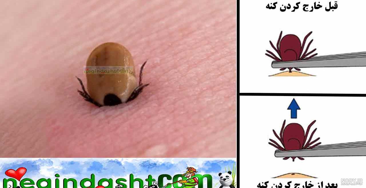 قیمت سمپاشی کنه کبوتر قیمت سمپاشی کنه کبوتر