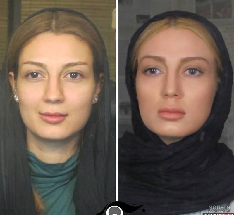 علت چاقی ژاله صامتی