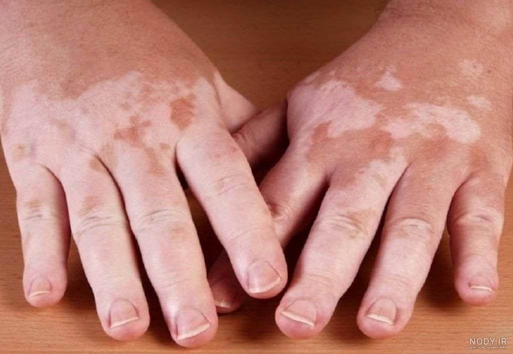 عکس لک سفید صورت عکس لک سفید صورت