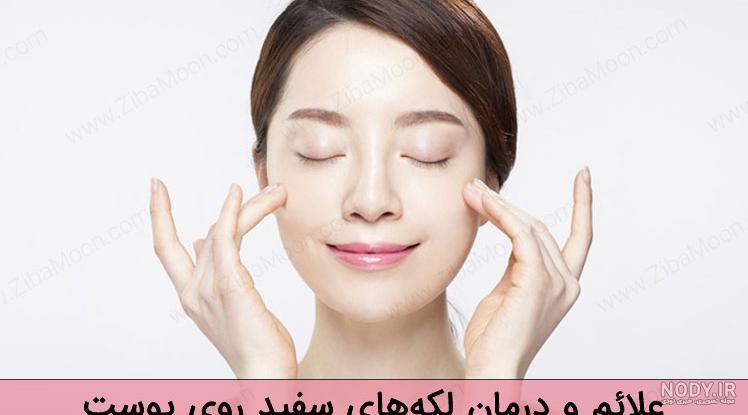 عکس لکه سفید روی پوست عکس لکه سفید روی پوست