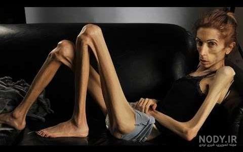عکس آدم لاغر زشت