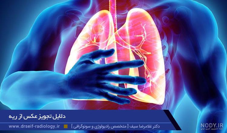 عکس از ریه چیست