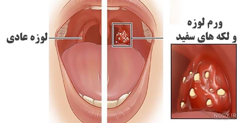 عکس داخل گلو انسان عکس داخل گلو انسان