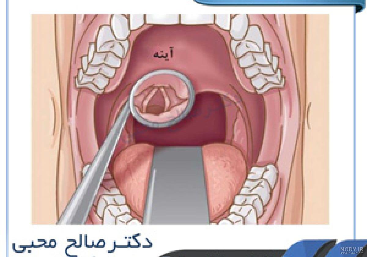 عکس داخل گلوله عکس داخل گلوله