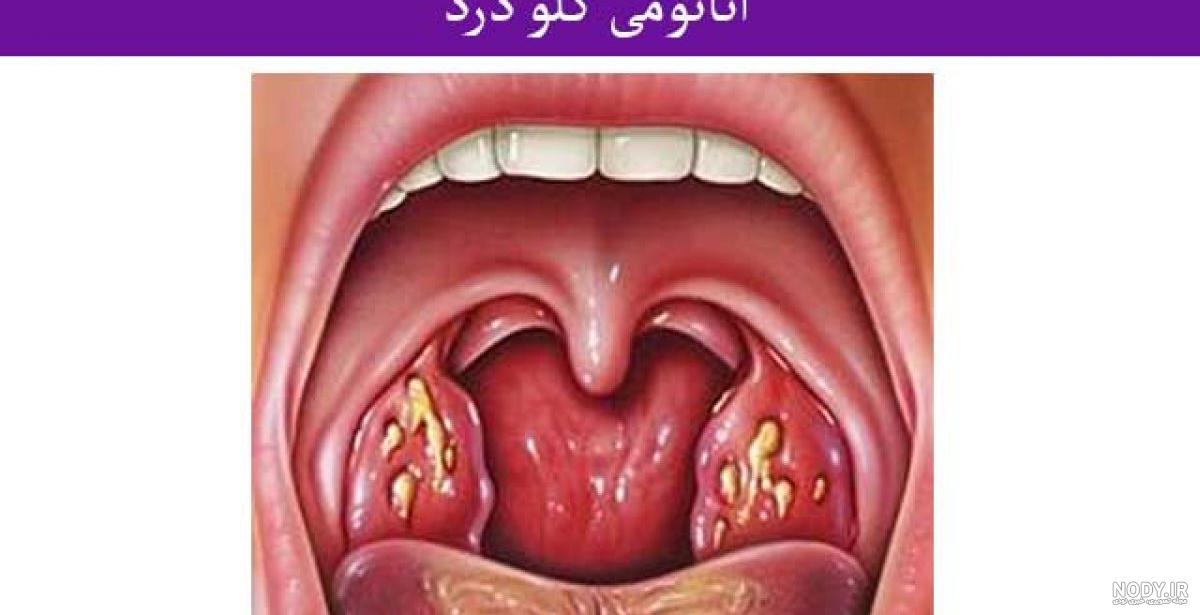 عکس داخل گلوی انسان عکس داخل گلوی انسان