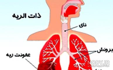 عکس ریه نرمال