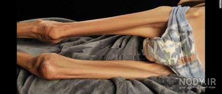 عکس زن زشت خنده دار