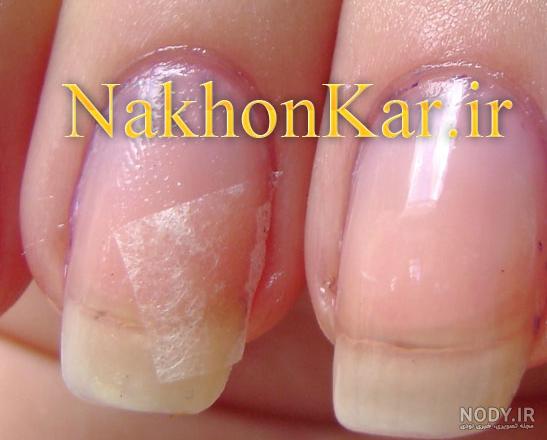 عکس ناخن شکسته دست