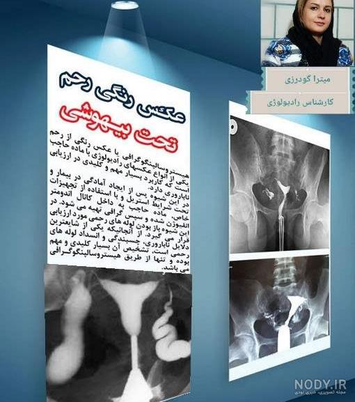 عکس رنگی نی نی سایت امروز