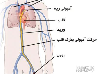 ورزش و آمبولی ریه ورزش و آمبولی ریه