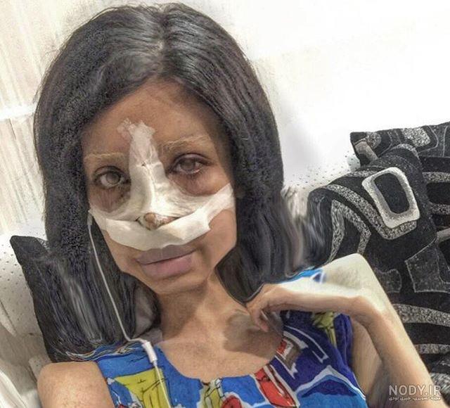 دست سحر تبر