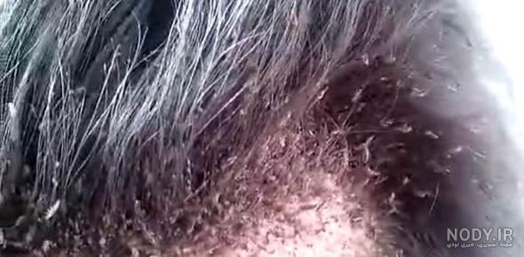 شپش از چی بوجود میاد