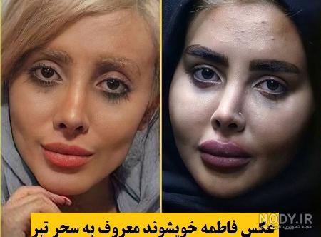 عکس تبر