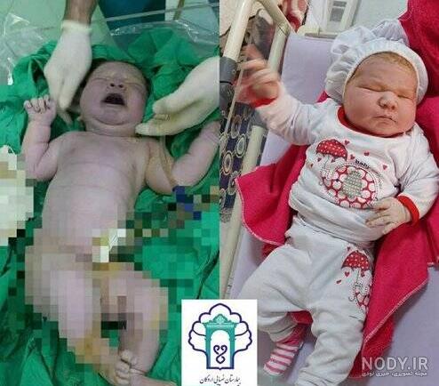 عکس نوزاد تازه متولد شده ایرانی