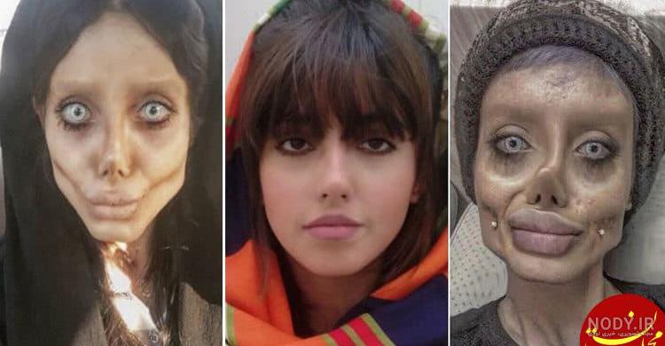 عکس واقعی سحر تبر بعد از عمل