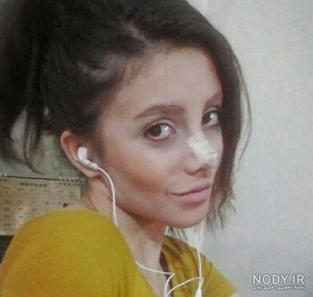 عکس واقعی سحر تبر قبل از عمل