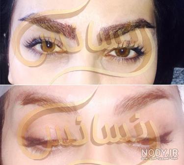 عکس کاشت ابرو مردانه عکس کاشت ابرو مردانه