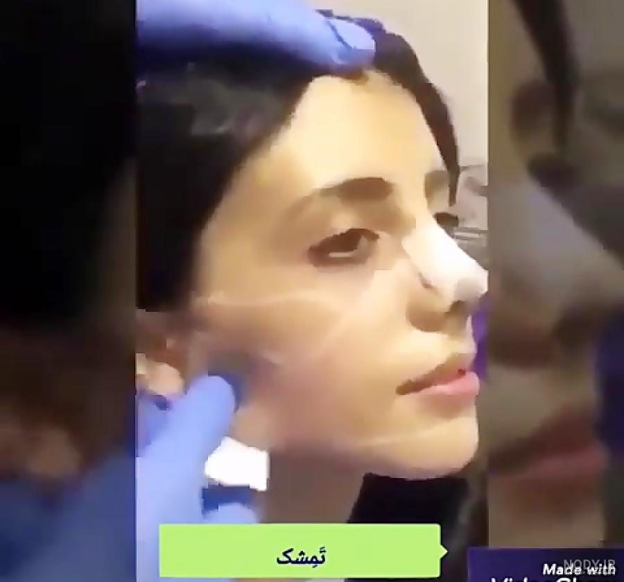 عکسهای واقعی سحر تبر